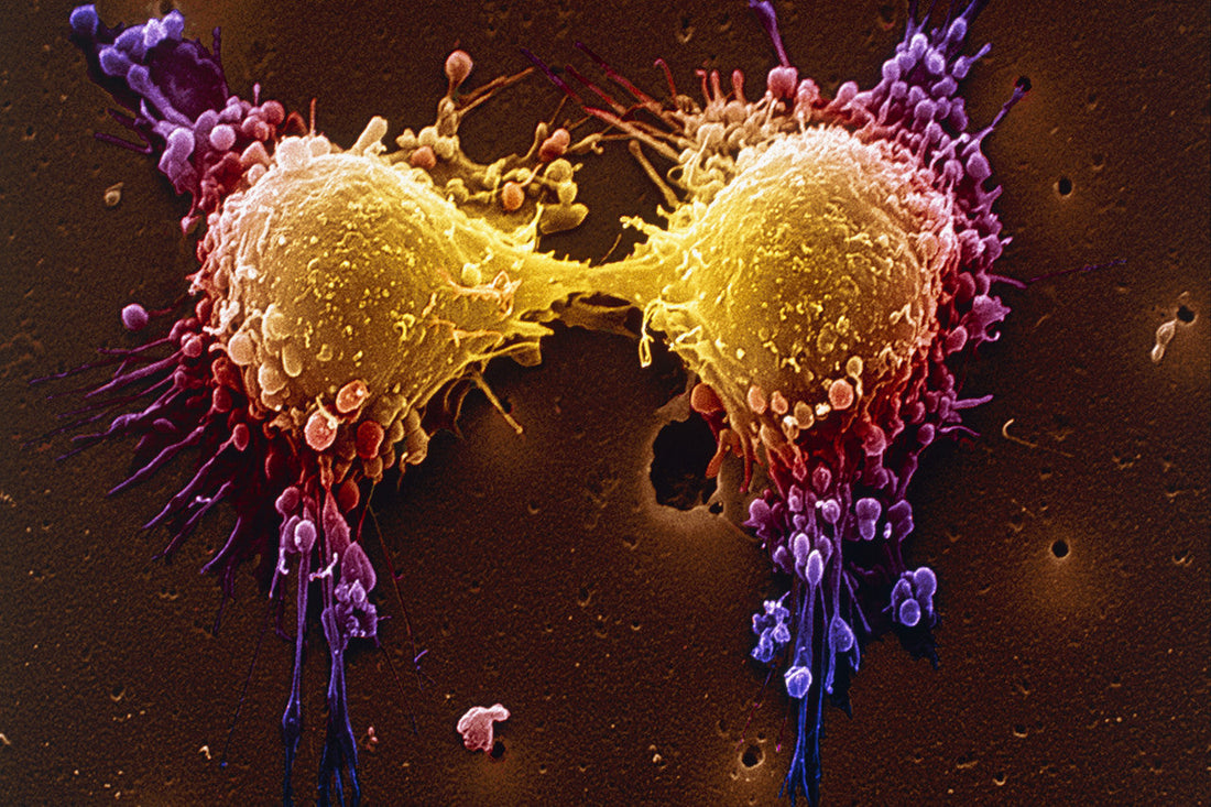 What the Latest Prostate Cancer Research Actually Tells You to Do.