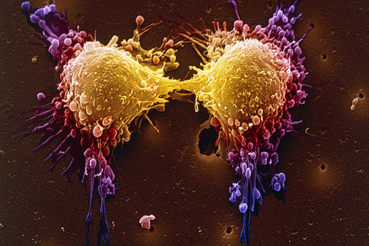 What the Latest Prostate Cancer Research Actually Tells You to Do.